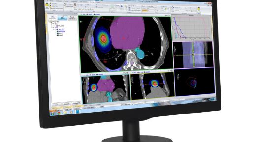 Angled monitor showing Monaco treatment plan screen