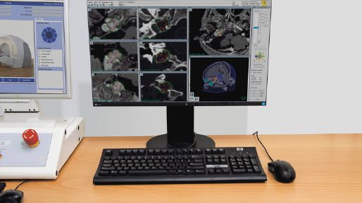 Monitor with Leksell Gamma Knife delivery screen