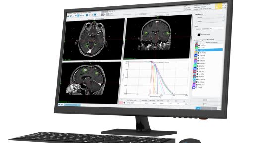 Monitor showing the Leksell GammaPlan software