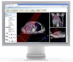 Elekta MOSAIQ Data Director Integrated Image and Data Archive for Oncology